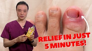 6 HOME REMEDIES To Treat A PAINFUL Ingrown Nail  Dr Kim [upl. by Hayidan]