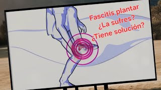 fascitis plantar ¿lo sufres [upl. by Hinze]