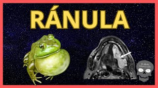 RÁNULA 🐸 Hallazgos Radiológicos [upl. by Michal]