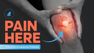 Chondromalacia Patellae  Runner’s Knee  Knee Pain Exercises  Knee Cap Pain [upl. by Batish]