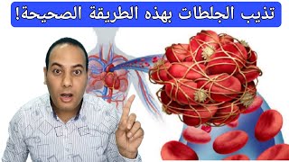 تذيب الجلطات بعد تطبيق هذه الطريقة الوحيدة الصحيحةأسرار الجلطاتفيتامين يفتت الجلطات [upl. by Skiest]