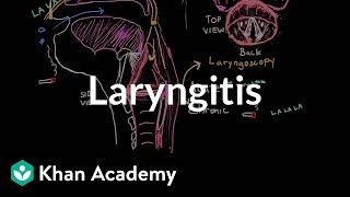 Laryngitis diagnosis treatment and prevention  NCLEXRN  Khan Academy [upl. by Ailem410]