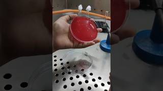 How To Streak For Blood Agar Plates Bacterial Streaking Technique [upl. by Orms53]