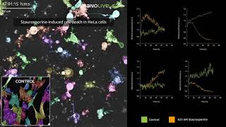 Quantitative analysis of the phenotypic response of HeLa cells to Staurosporine [upl. by Natanhoj]