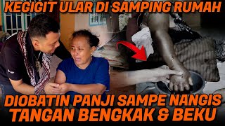 PANJI PETUALANG TOLONG IBU KORBAN GIGITAN ULAR VIPER TANAH KONDISI TANGAN BENGKAK BERNANAH [upl. by Havens]