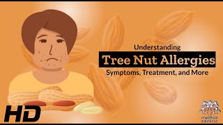 Tree Nut Allergies 101 A Comprehensive Guide to Your Health [upl. by Agn]