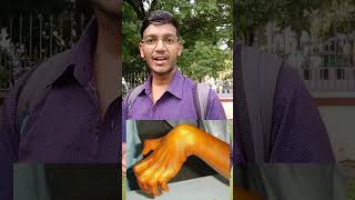 Deformity m kon si Nerve affect hoti hai 🤗shortsanatomybhushortsviralmedicosmedicalstudentyt [upl. by Aihsar]