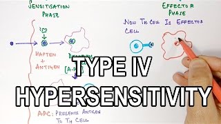 Type IV Hypersensitivity [upl. by Voltz]