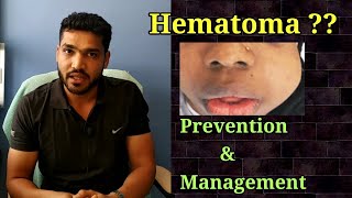 Hematoma PSA Complication  Prevention amp Management [upl. by Pucida]