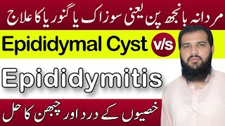 Epididymitis treatment in hindi  Epididymal cyst treatment  sozak Ka ilaj  Epididymitis [upl. by Barbaraanne]