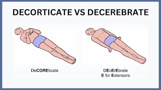 Decorticate vs Decerebrate Explained [upl. by Leroi]