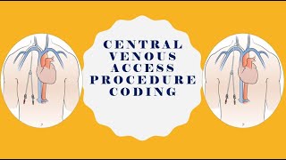 CARDIOVASCULAR SYSTEM CODING CENTRAL VENOUS ACCESS PROCEDURES  MEDICLUX CODING TRAINING [upl. by Alvie]