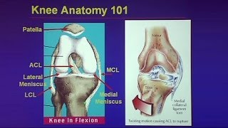 Common Traumatic Knee Injuries Oh My Aching Knee [upl. by Aida572]