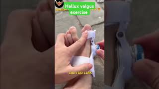 Hallux valgus exercise  Hallux valgus medical solution sorts amry sscgd ssccpo [upl. by Vinia]