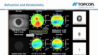 Topcon KR 1W wavefront amp topography system [upl. by Adamok284]