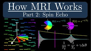 MRI Pulse Sequences Part 1 SpinEcho [upl. by Reviere]