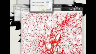 Quantifying Stained Liver Tissue Area Using ImageJ [upl. by Hiroko]