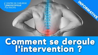 CHIRURGIE ENDOSCOPIQUE  Comment se déroule lintervention [upl. by Eima]