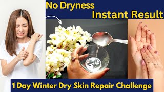 1 Day Winter Dry Skin Repair Challenge  Winter Dry Skin Care  Miss Chocopuri [upl. by Laure293]