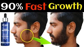 90 Beard की Growth Up कर देगा ये Beardo Hair Growth Scalp Regenesis HairBeard Tonic [upl. by Masuh221]