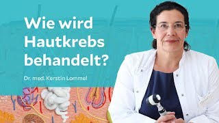 Wie wird Hautkrebs behandelt [upl. by Yvel306]