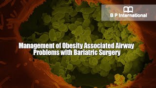 Management of Obesity Associated Airway Problems with Bariatric Surgery [upl. by Nerol343]