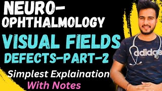 Visual Field Defect2Lesions Of Visual PathwayNEUROOPHTHALMOLOGY [upl. by Anyalram]