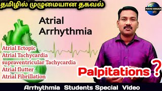 Atrial Arrhythmia in tamil  Atrial ectopic supraventricular Tachycardia SVT Flutter fibrillation [upl. by Babb]