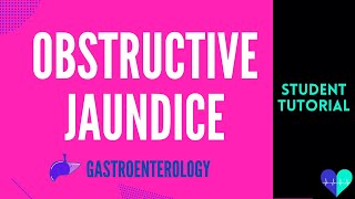 Obstructive Jaundice  Medical Tutorial [upl. by Ecertal420]