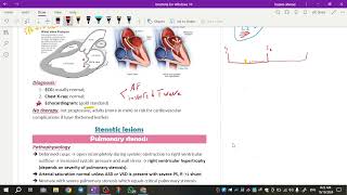 Pediatrics cardiology  MP amp PS amp AS amp coarctation of aorta [upl. by Odlabu]