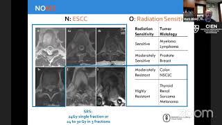 25 The EverChanging Role of Surgery in the Treatment of Metastatic Spine Tumors by Dr Mark Bilsky [upl. by Diamond]