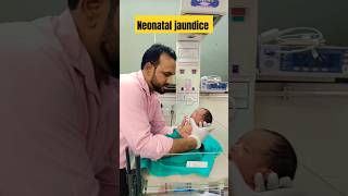 Neonatal jaundice  nicu jaundice jaundicetreatment newborn [upl. by Goerke]