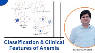 Classification amp Clinical Features of Anemia  Blood Physiology  RBCs [upl. by Einahpehs]