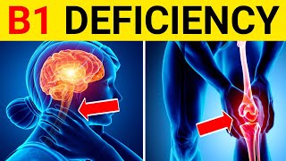 9 Signs and Symptoms of Thiamine Vitamin B1 Deficiency  Thiamine Deficiency Symptoms [upl. by Andrien]