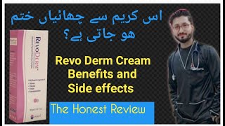 How to use revo derm creamside effects and benefits the honest review [upl. by Iredale640]