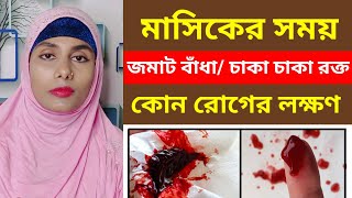 মাসিকের সময় জমাট বাধা রক্ত কেন আসেএর লক্ষণ চিকিৎসা ও মুক্তির উপায় কি  Blood clots in period [upl. by Walls]