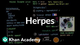 Diagnosis treatment and prevention of herpes  Infectious diseases  NCLEXRN  Khan Academy [upl. by Ratep747]