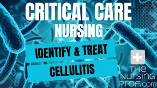 Critical Care Nursing Identify and Treat Cellulitis [upl. by Bondon]