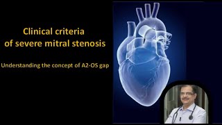 Clinical Criteria of Severe Mitral Stenosis Understanding A2 Opening Snap Gap amp Murmur Length [upl. by Eudocia586]