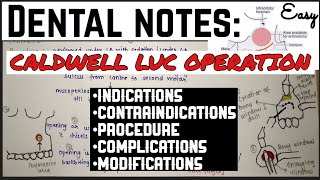 CALDWELL LUC OPERATION  MAXILLARY SINUS  ORAL SURGERY  imp [upl. by Leupold787]