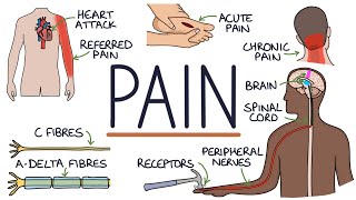 Understanding The Causes of Pain and Pain Management [upl. by Drauode]