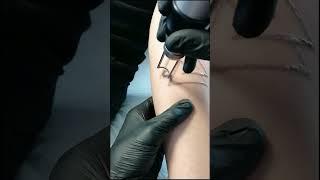 aparat cu laser tatuaje [upl. by Dash]