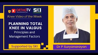 Planning Total Knee in valgus deformity  Dr P Suryanarayan [upl. by Kermy117]