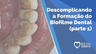 Formação do Biofilme Dental parte 1 [upl. by Attekahs]