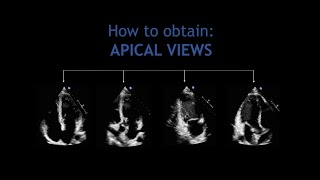 How to obtain APICAL VIEWS Echocardiography [upl. by Goodrow]