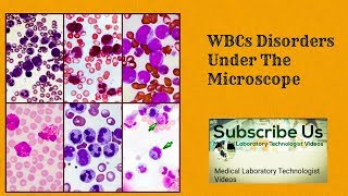 WBC Disorders Under The Microscope [upl. by Timms742]