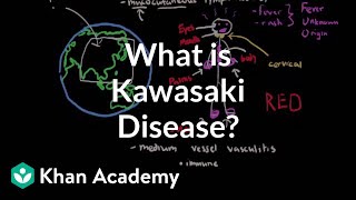 What is Kawasaki disease  Circulatory System and Disease  NCLEXRN  Khan Academy [upl. by Quick]