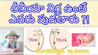 లీనియ నిగ్ర అర్థం ఇదే  Gender Symptoms During Pregnancy In Telugu  Linea Nigra  trending [upl. by Amsirak]