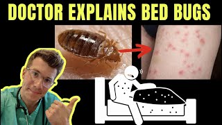 Doctor explains BED BUGS  including SYMPTOMS TREATMENT AND PREVENTION  PHOTOS [upl. by Leirea]