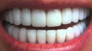 Get Perfectly Straight Teeth―∎ affirmations  Cure Overbite Underbite amp Crossbite [upl. by Xanthe]